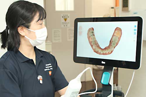 3D歯並びスキャン